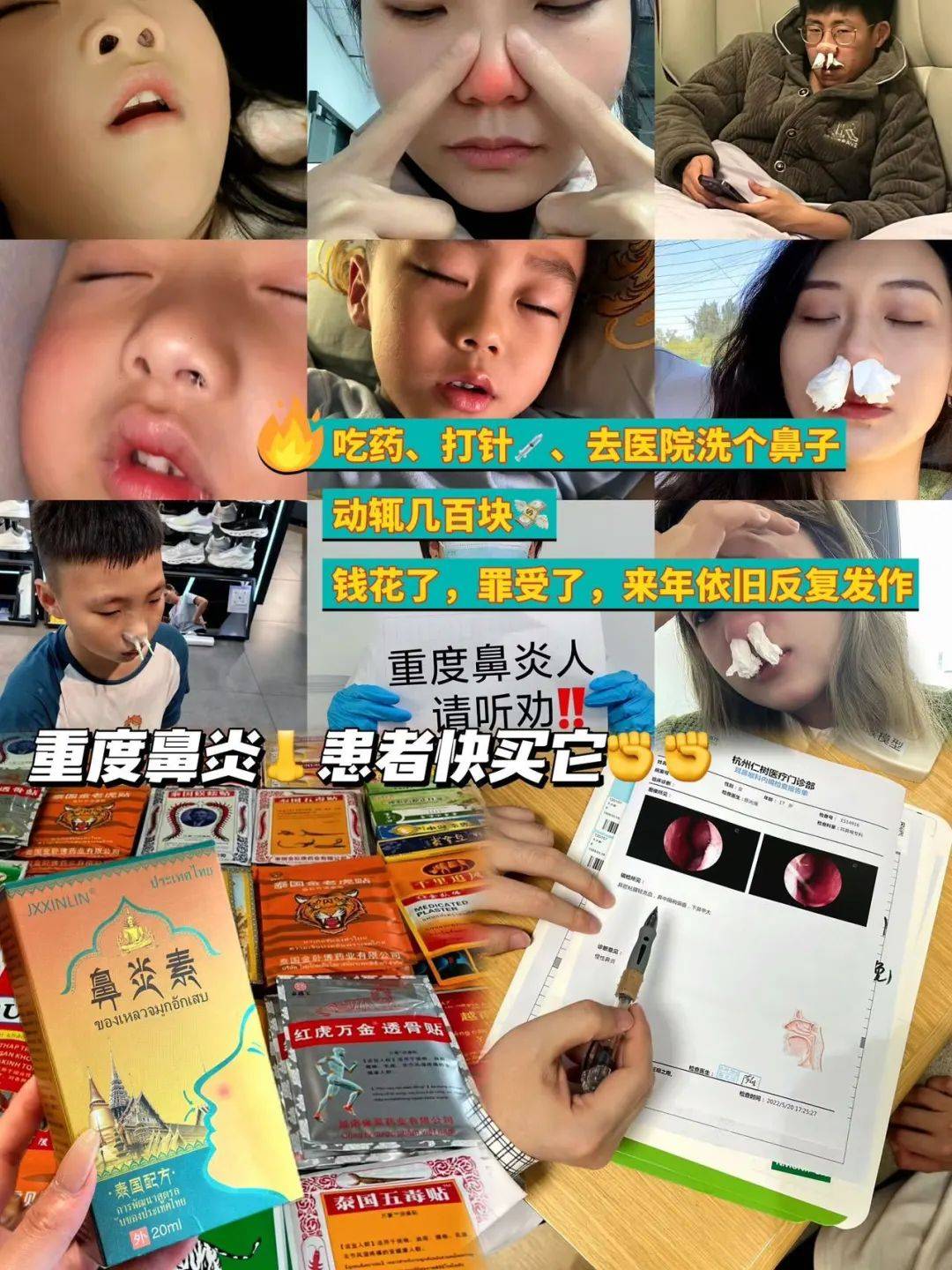 彻底根治鼻炎,防复发,无需手术 泰国鼻炎素喷雾:天然中草药 通利鼻窍