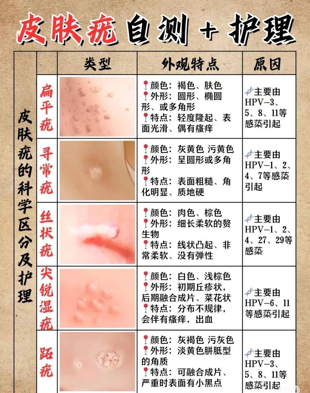 高危型 hpv 持续感染