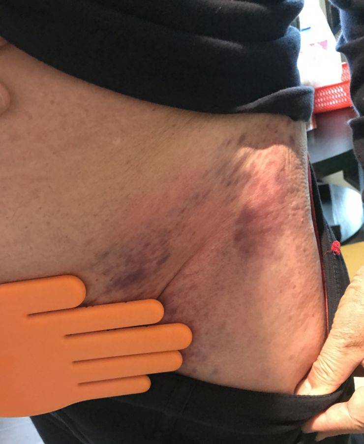 女性嘴唇腹股沟颜色越深说明血液子宫越脏
