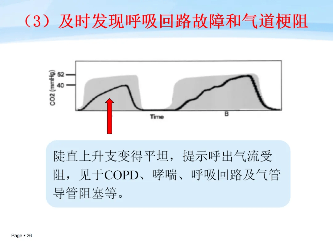 呼气末二氧化碳分压监测