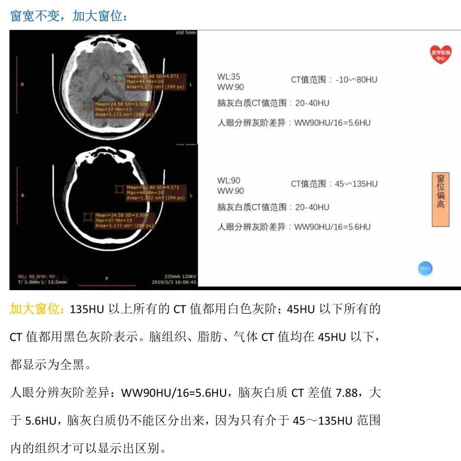 联影ct 参数图片