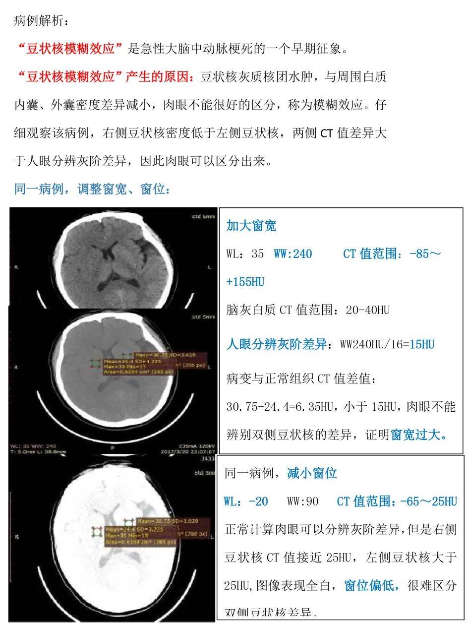 头针语言中枢图片