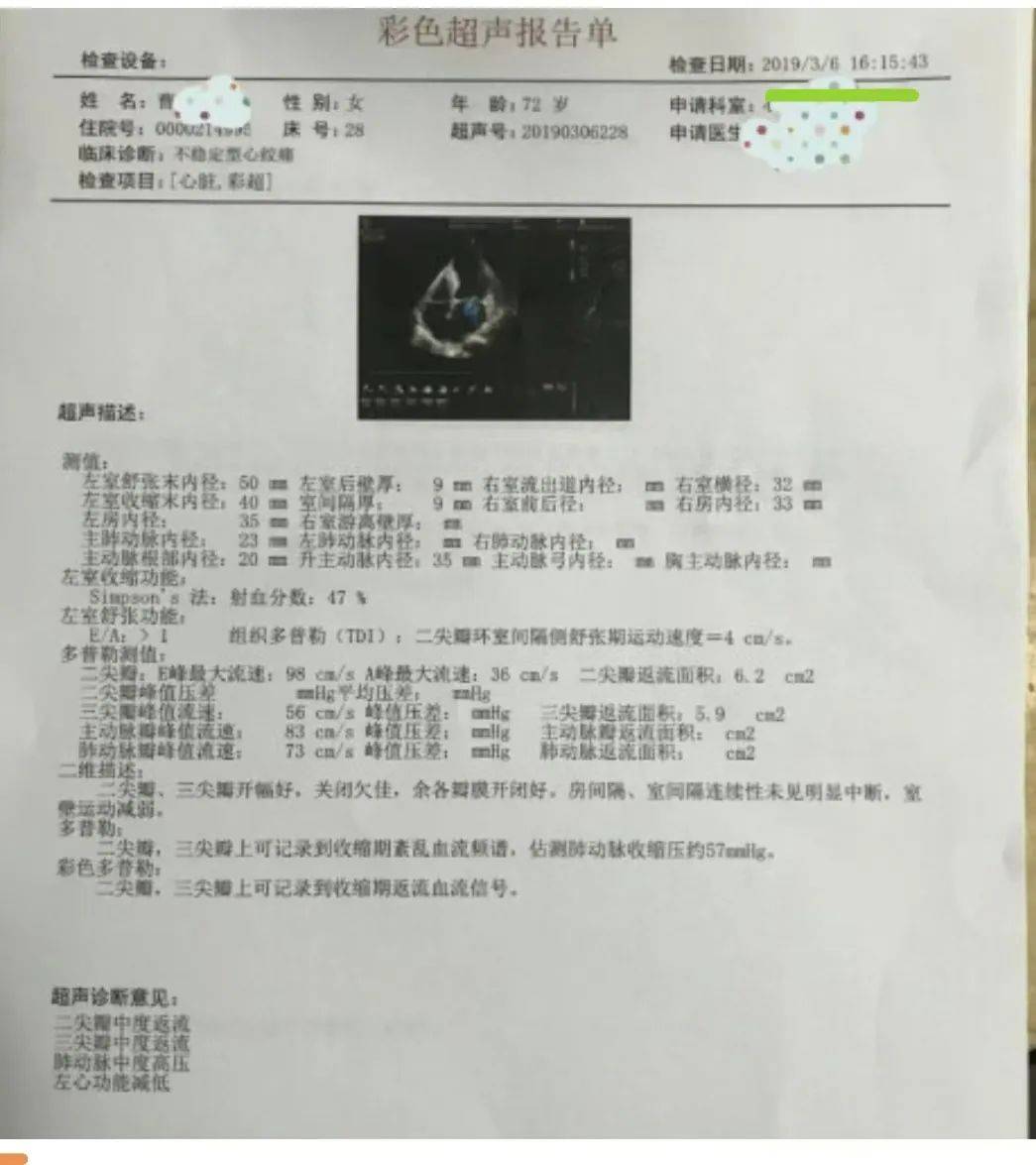 心肌酶检查报告单图片图片