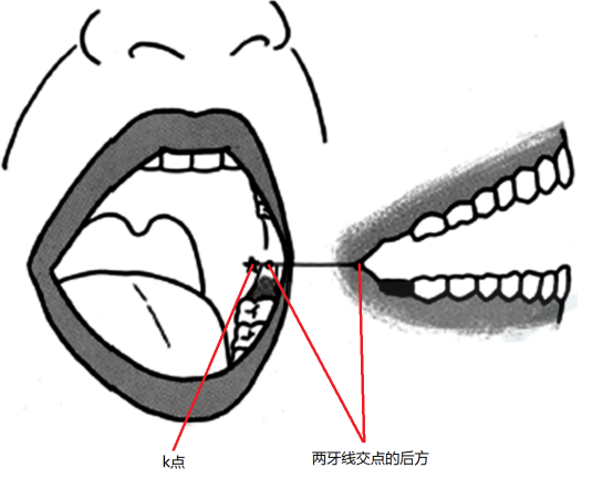 难插性胃管插入技巧：只需多做一步！还有很多护士不知道~_患者_食管_动作