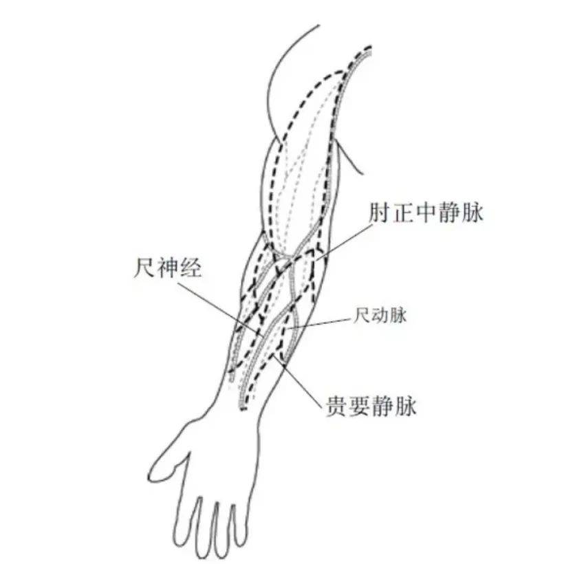 静脉血一般从手臂等部位的静脉丛采集