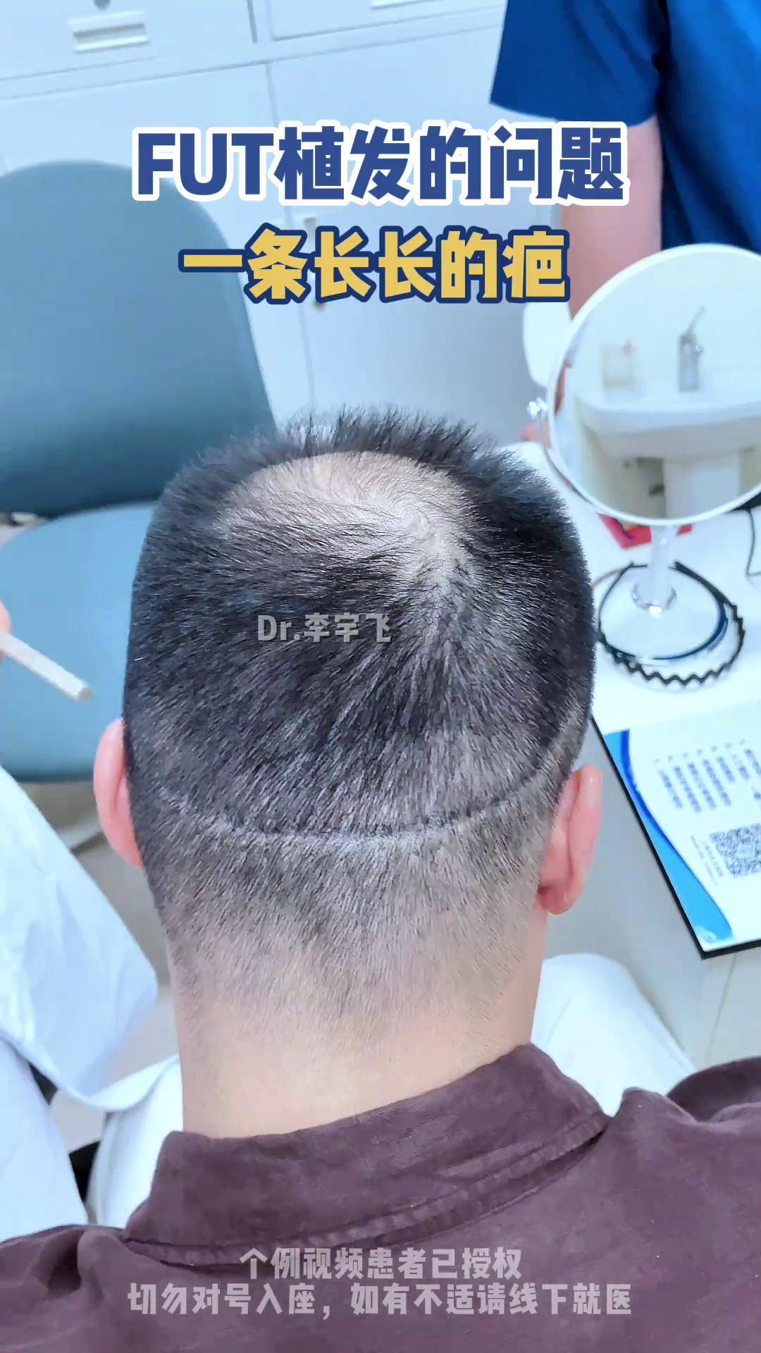 个人植发团队(个人植发团队介绍)