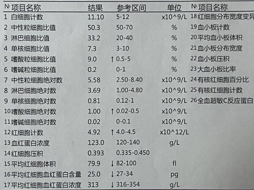 血常规hplt正常图图片