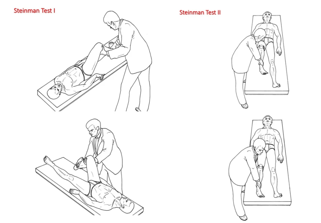 屈髋伸膝试验示意图图片