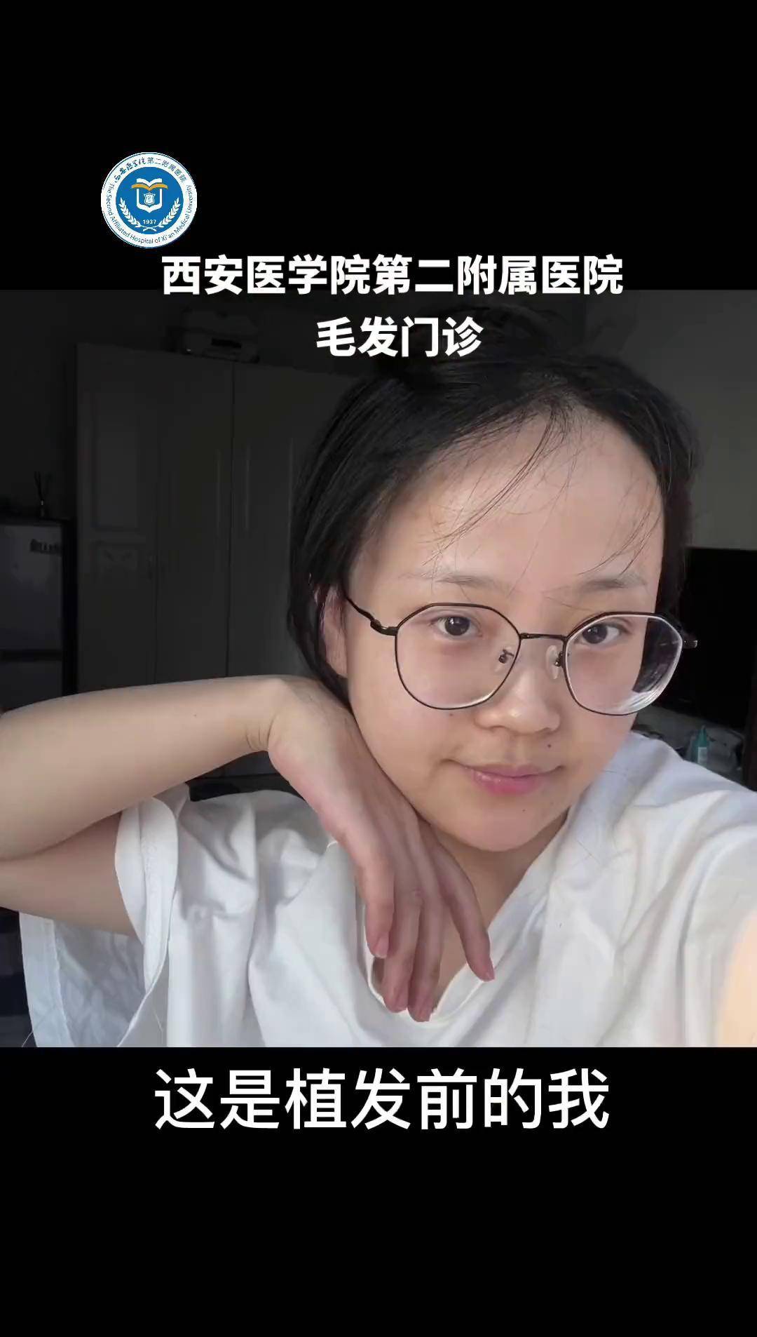 西安植发事故(西安植发最贵多少钱)