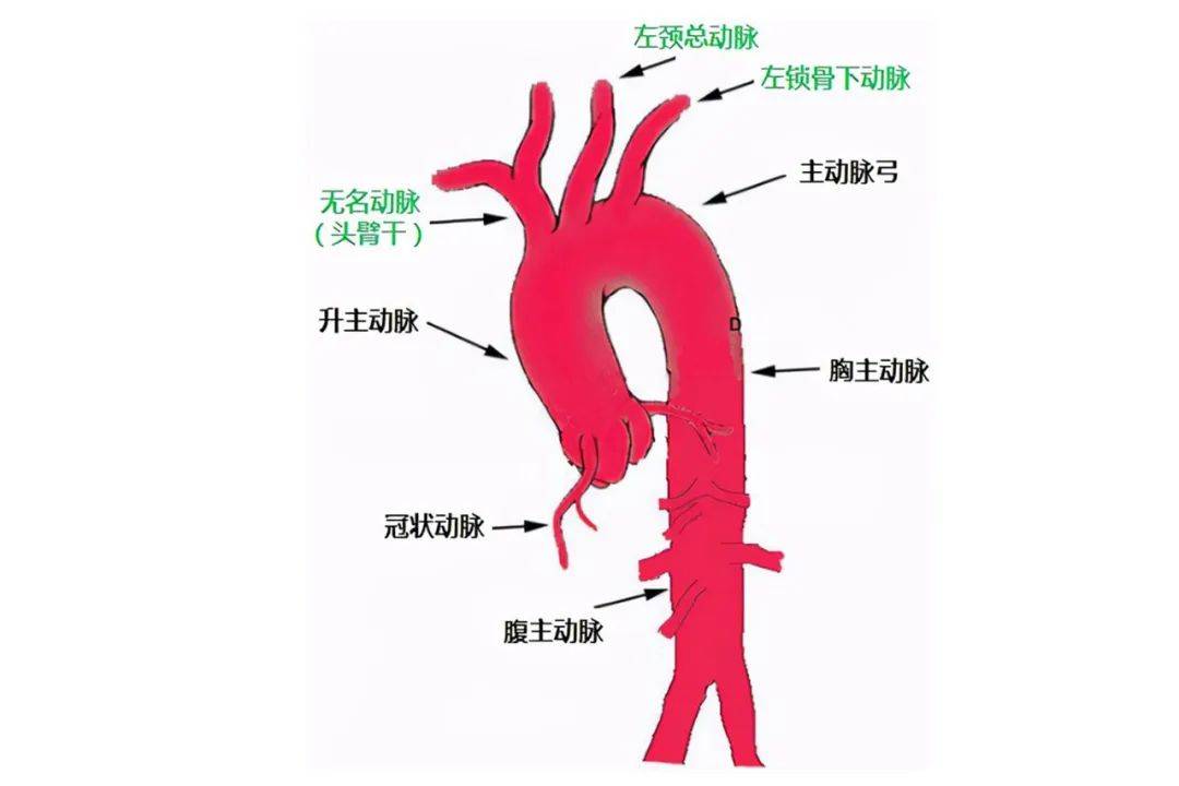 完成省内首例胸腹主动脉瘤腔内修复 胸主动脉瘤腹膜支架体内开窗术