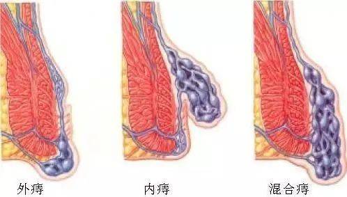 肛门瘙痒挂号挂什么科(肛门瘙痒应该挂什么科室)