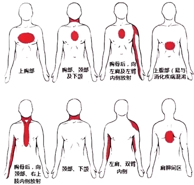 胸口下面疼是什么原因图片