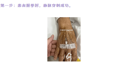 留置针总是输液不畅?是你贴膜贴错了!