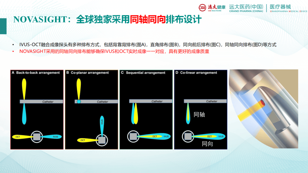 ICCD 2024 | 全球首个FDA获批的IVUS-OCT融合成像系统NOVASIGHT开启腔内影像新篇章_血管_技术_病变