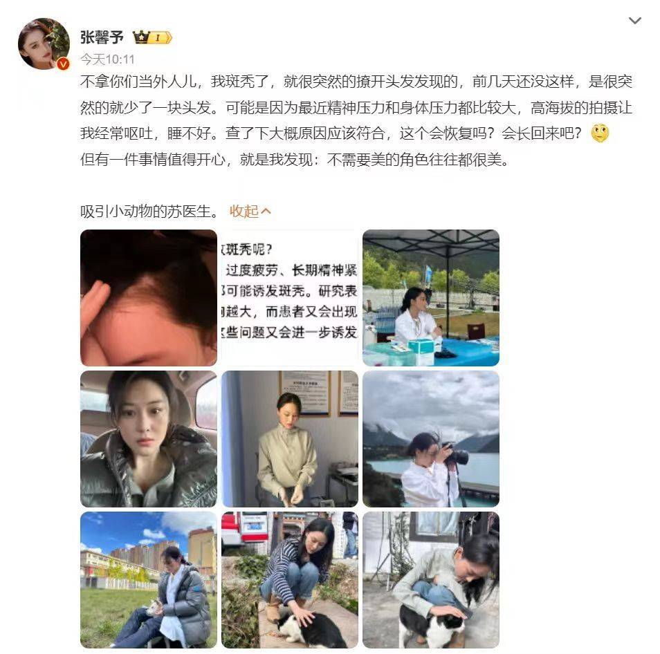 知名女星自爆斑秃上热搜，专家：针灸对治疗脱发有特效