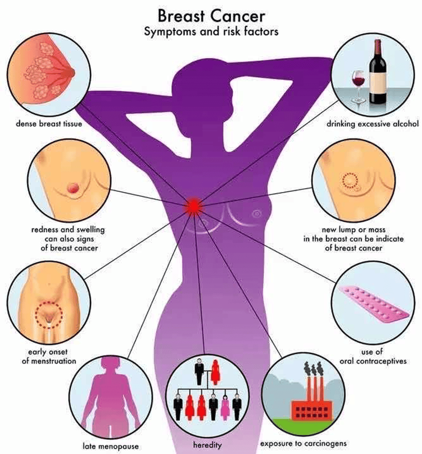 乳房四个象限平面图图片