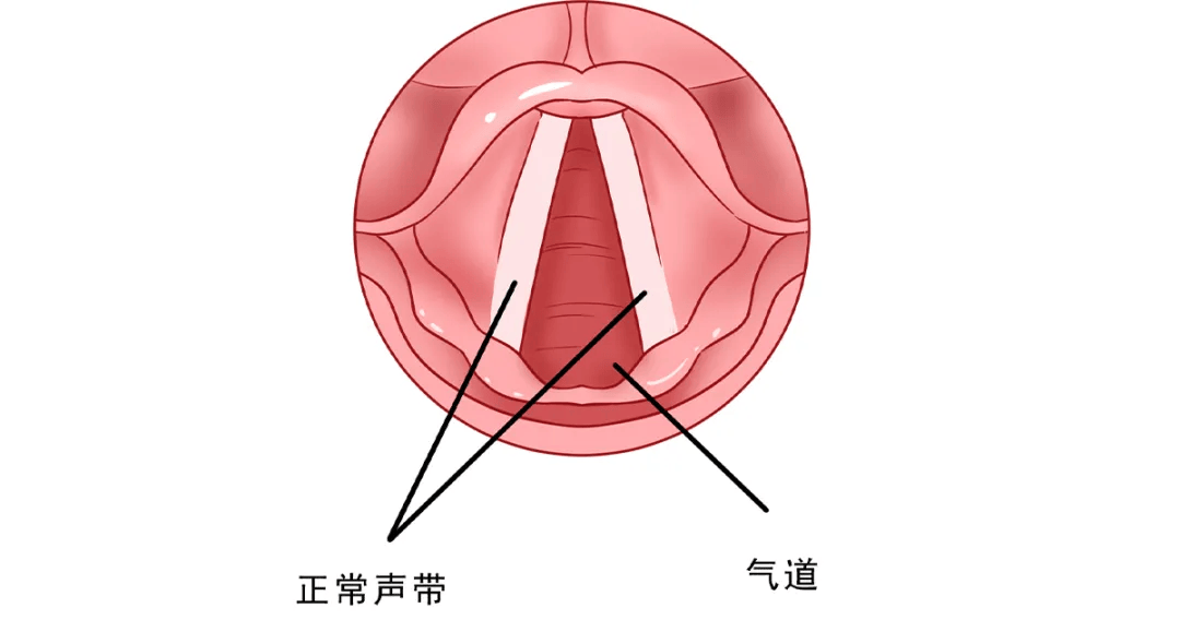 声门上区示意图图片