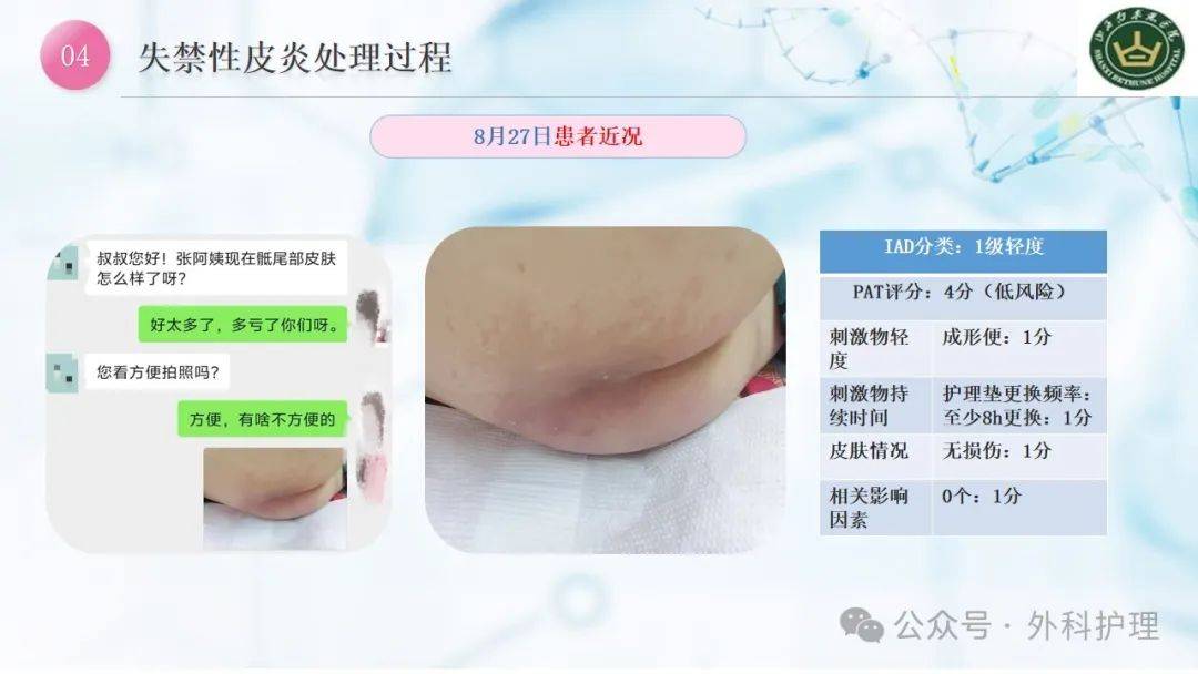 【ppt】一例骨盆骨折失禁性皮炎患者的案例分享