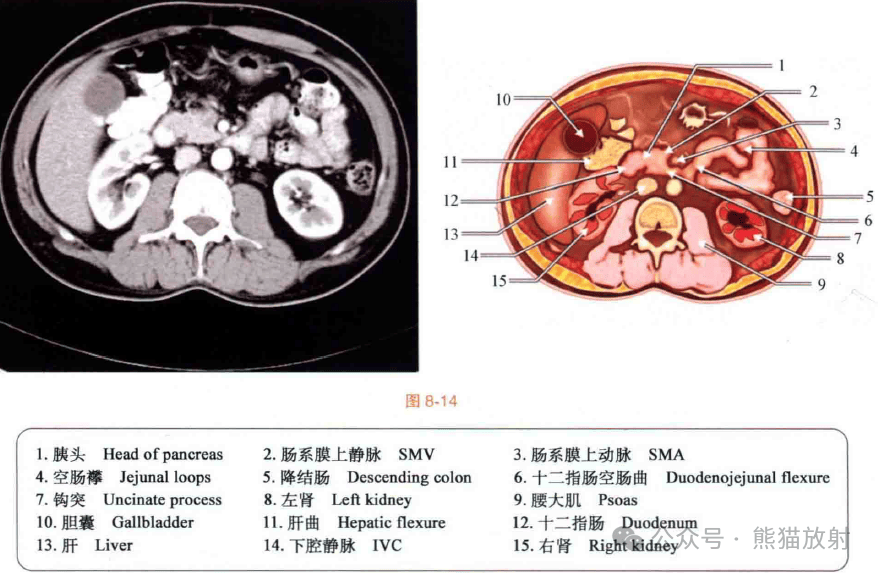 厚腹梁与薄腹梁图片