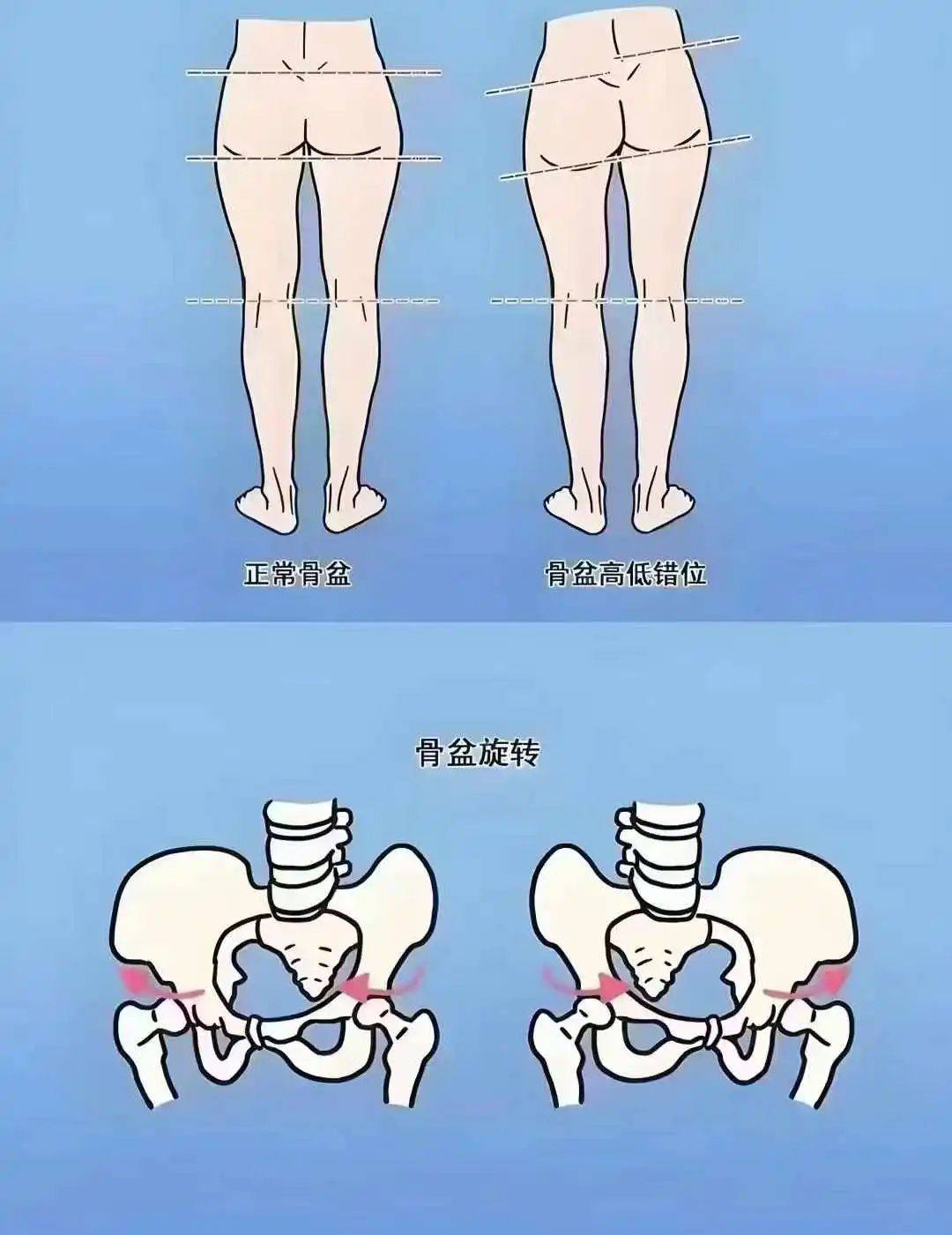 【科普】产后妈妈必看!骨盆修复,重塑美丽与健康的关键一步