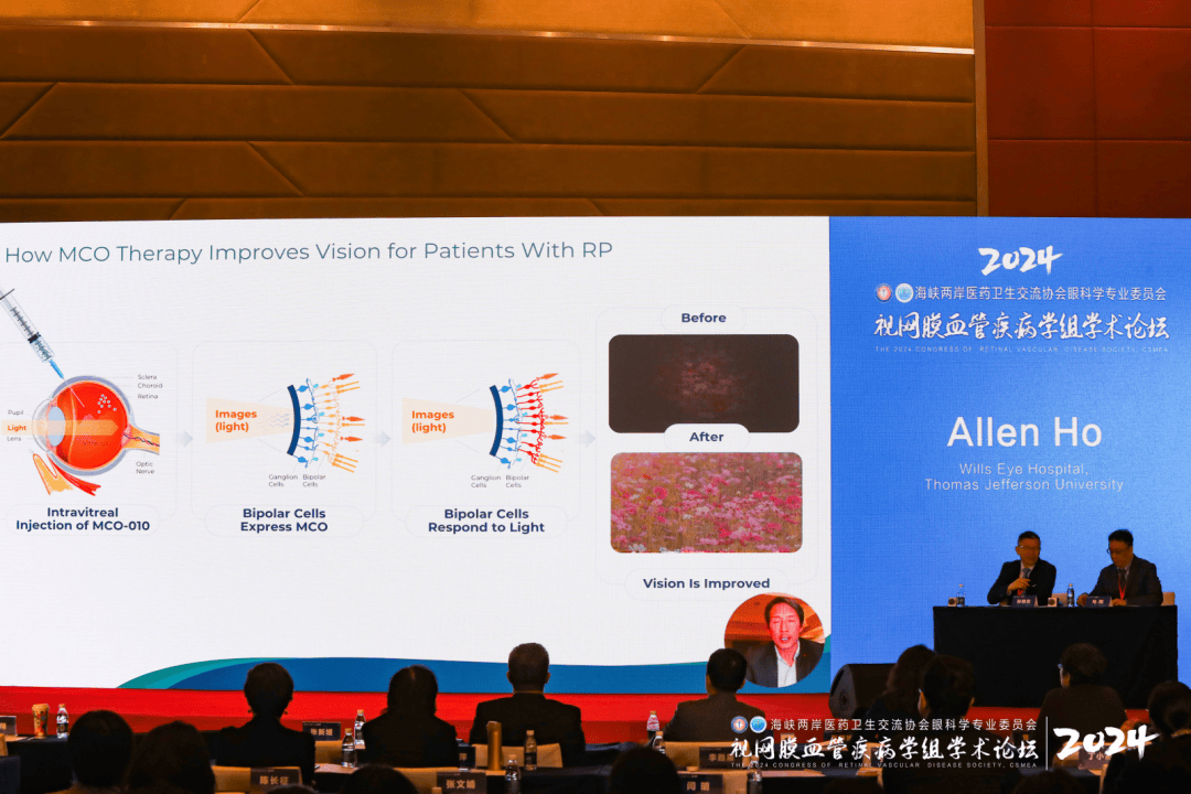 追光而行，行将致远：2024年海峡两岸医药卫生交流协会眼科学专委会——视网膜血管疾病学组学术论坛盛大开幕(图10)