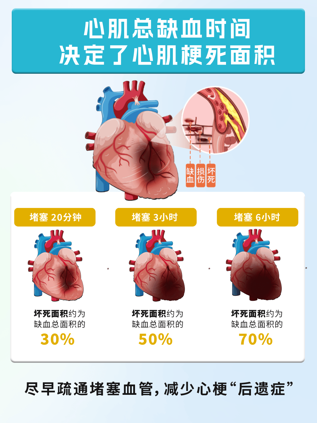 拖延时间越久,心功能损伤越多[2]会发生不可逆性的坏死心肌细胞缺血