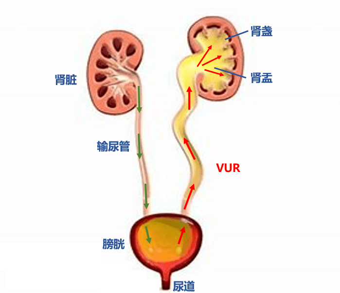 胎儿男女膀胱图图片