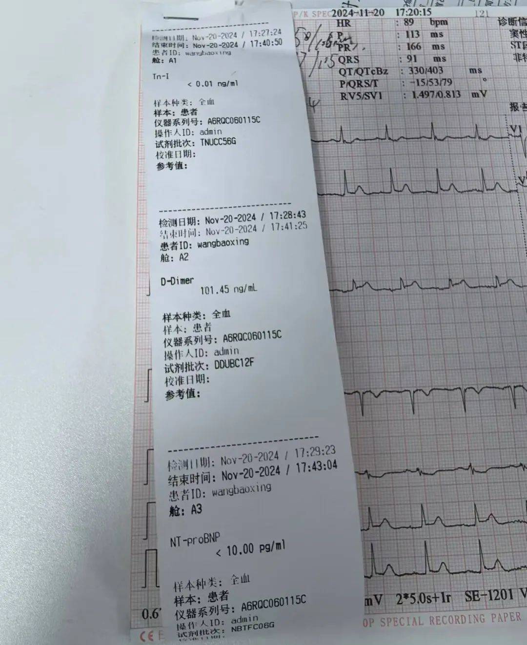 心肌梗塞的报告图片图片