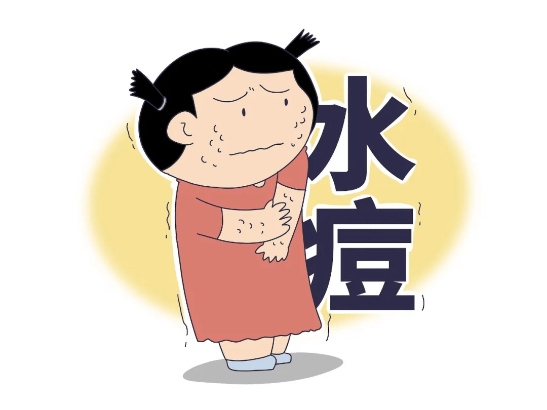 专家提醒_水痘_接种_孩子