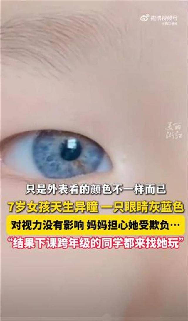 江西7岁女孩天生异瞳受到同学喜爱，医生：出现这些情况应及时治疗