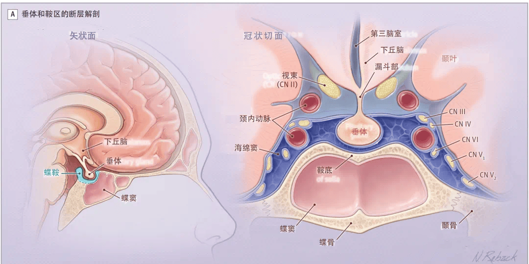 垂体瘤的位置解剖图片图片