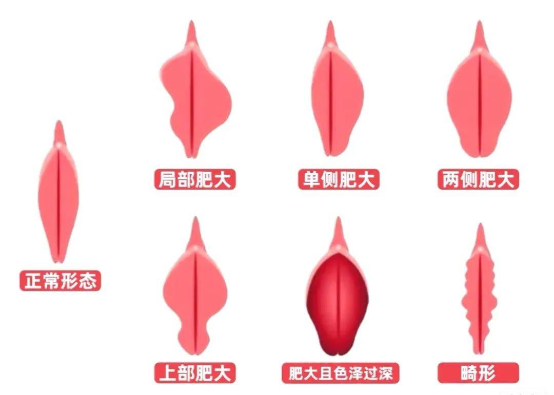 女性分泌物尿液图片