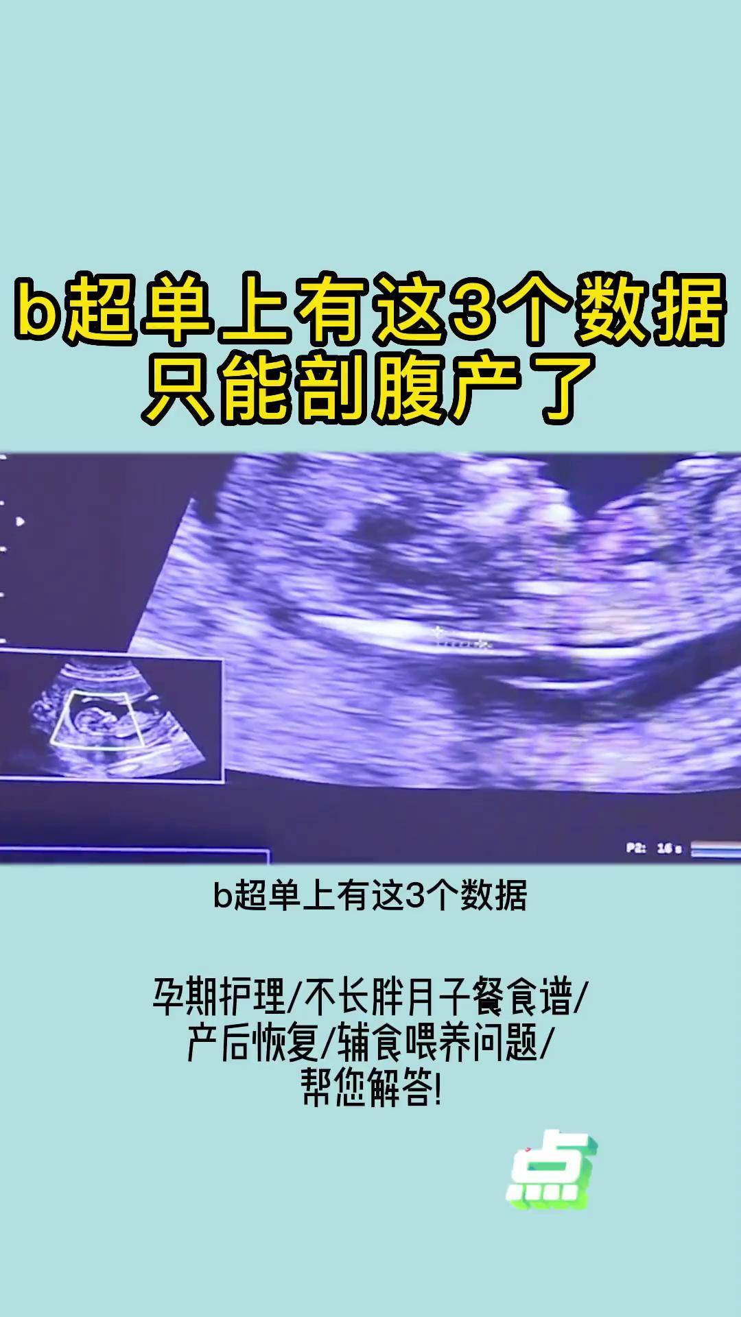 b超单上有这3个数据只能剖腹产了四维彩超 孕期 孕妈