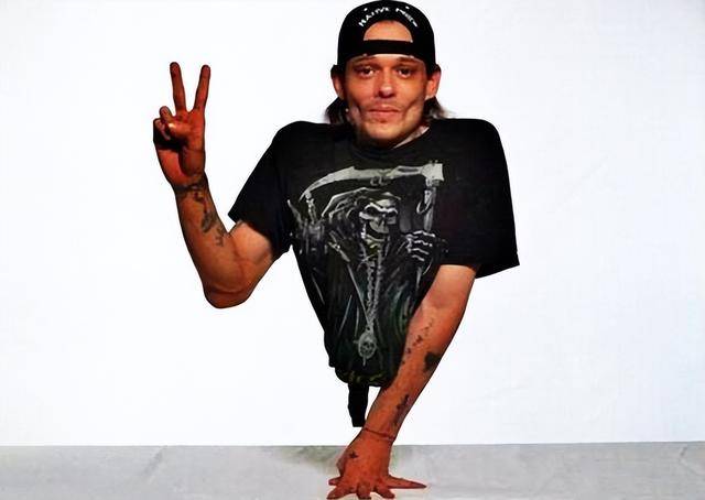 "半身人"娶年轻妻子,婚后生下漂亮女儿,亲子鉴定后乱套了_肯尼_生活