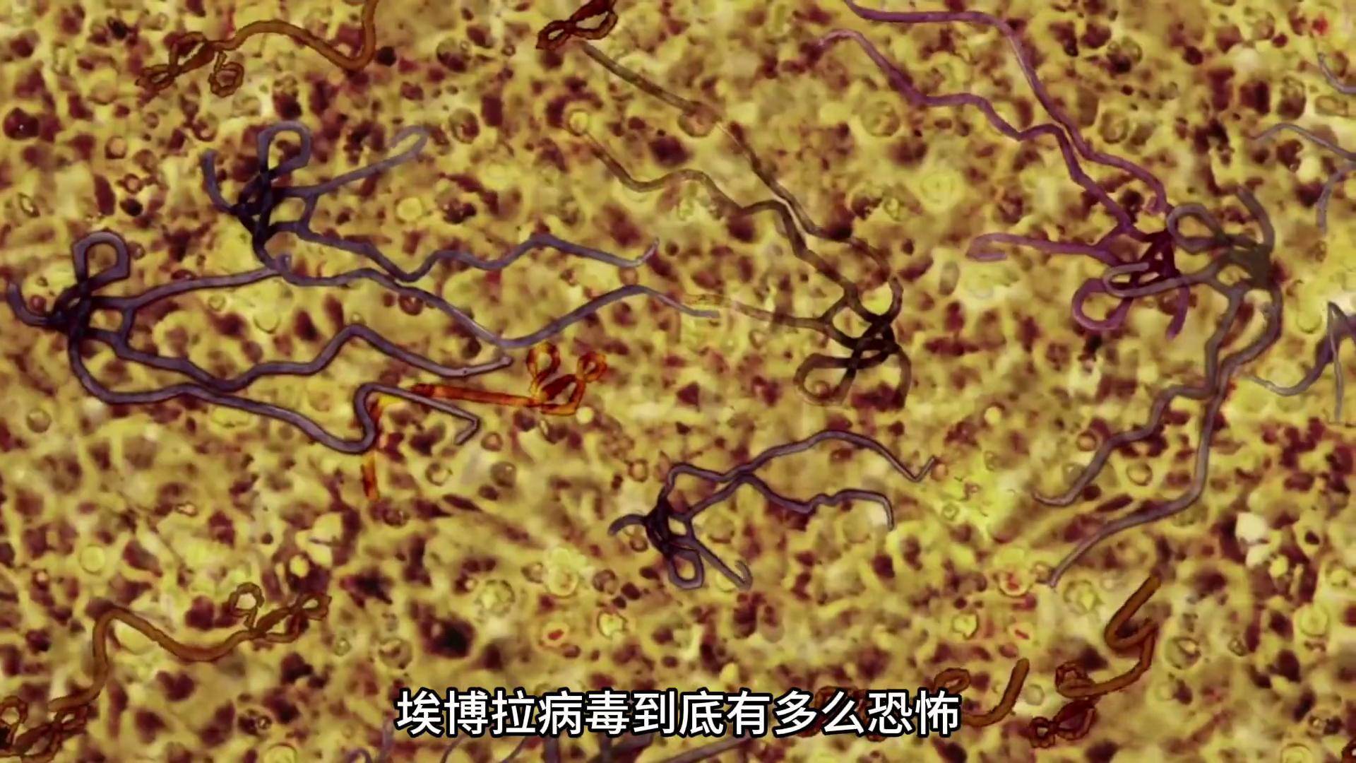 如远古丧尸般的病毒,埃博拉到底有多么可怕?