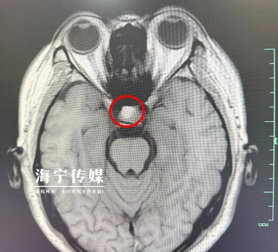 海宁男子不舒服7年,忍着不检查,如今医生惊呼"危险"了