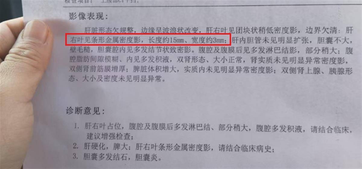 癌症病人做手术针头落体内，院方：建议不取，赔偿在协商中