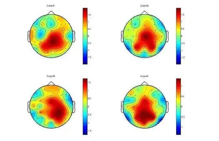金博智慧:用脑电地形图 "看" 清注意力