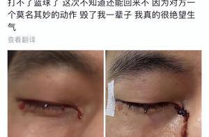 知名男篮队员发文痛诉眼伤,结膜裂伤到底能不能恢复好?_广东省_伤势_手术