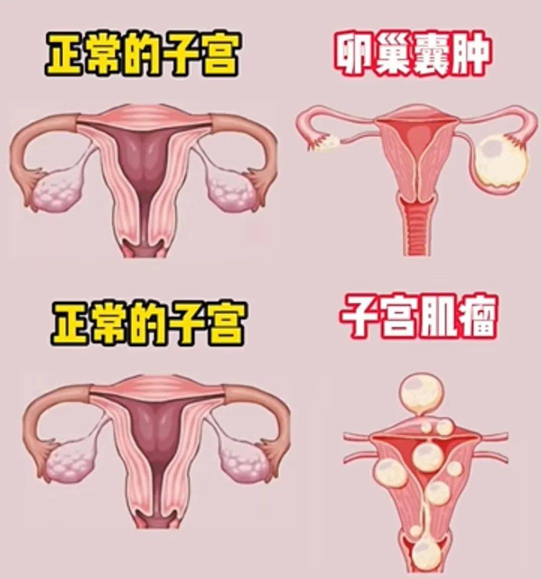 疾病_影响_卵巢