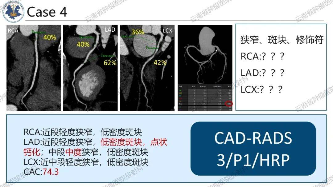 为什么不建议做冠脉cta检查