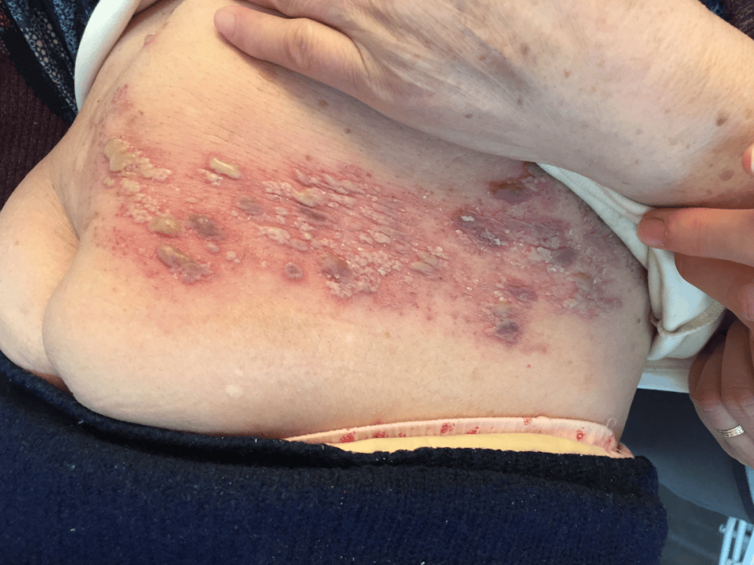 大兴区中西医结合医院疼痛科