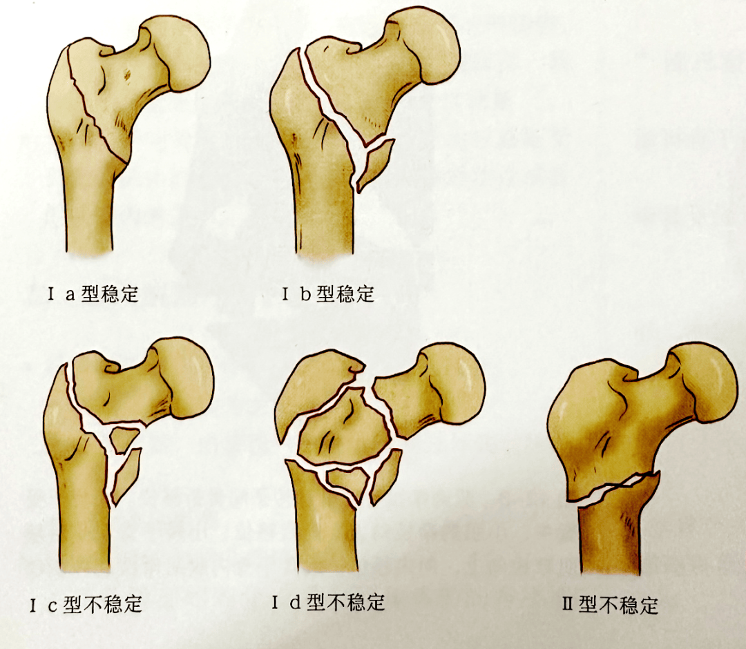 冠县新华医院丨科普