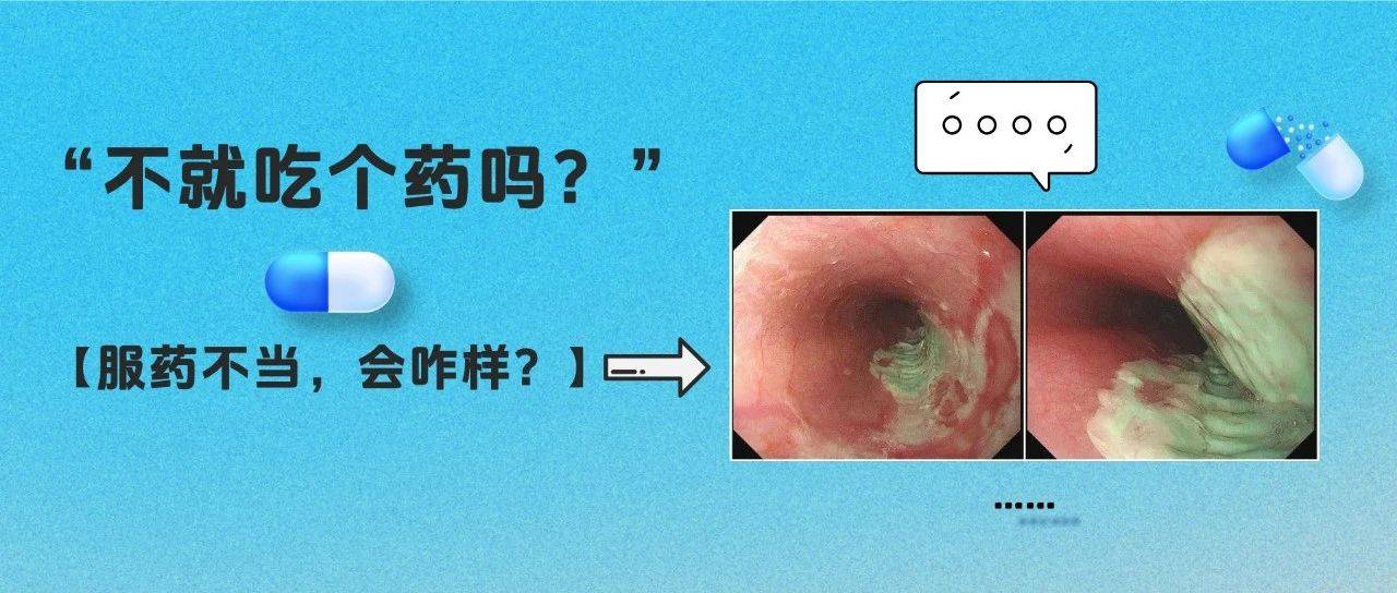 睡前吃了它，一觉醒来食管被“腐蚀”？！这个日常习惯很多人都忽视了_药物_小时_饮水量