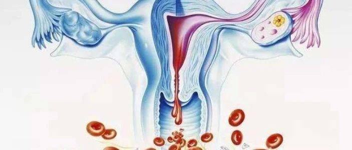 月经血中的“生命宝藏”——子宫内膜(宫血)干细胞_女性_治疗_卵巢
