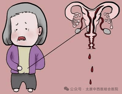 包罗
生殖科理疗后月经正常吗女的词条