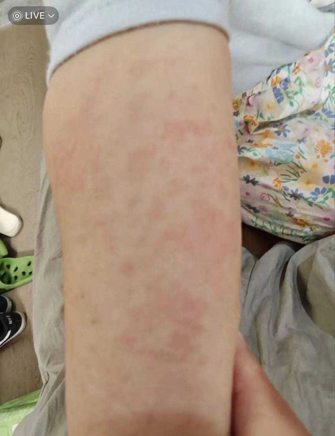 不要摸！不要摸！上海多区发现，有女子崩溃：去医院也清理不干净