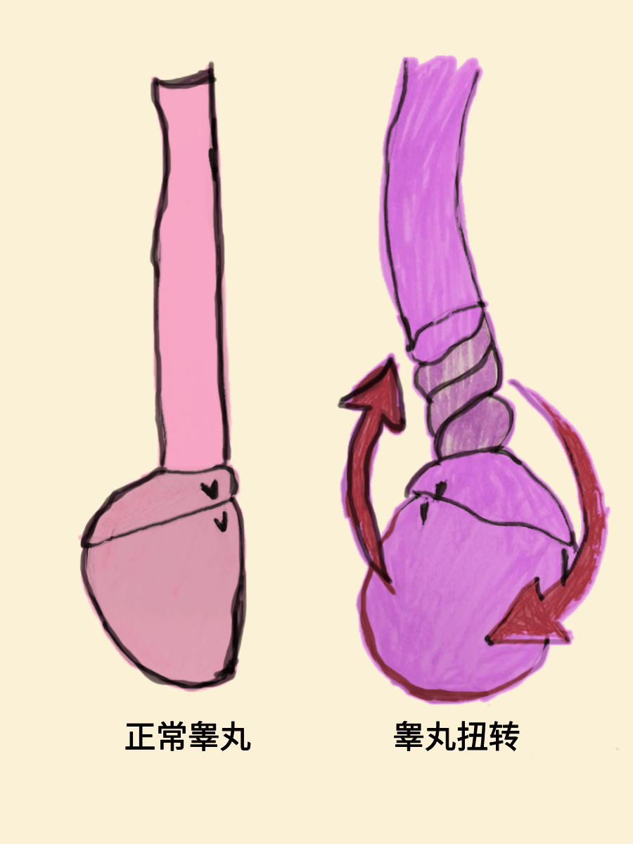 和连接它的"绳子"