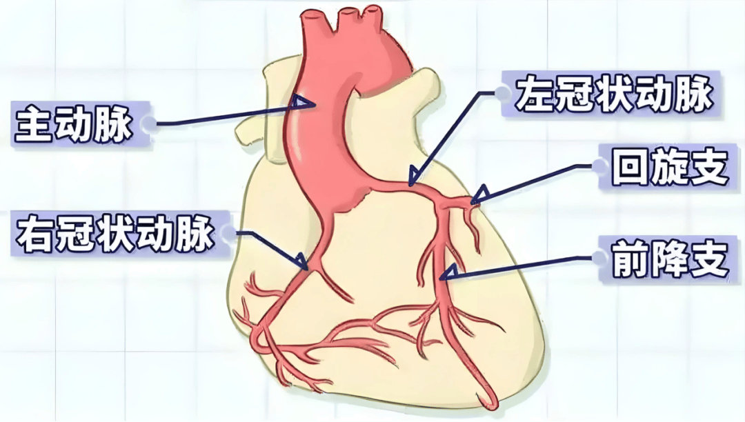 新技术 | 微创介入堵塞冠状动脉"缺口"