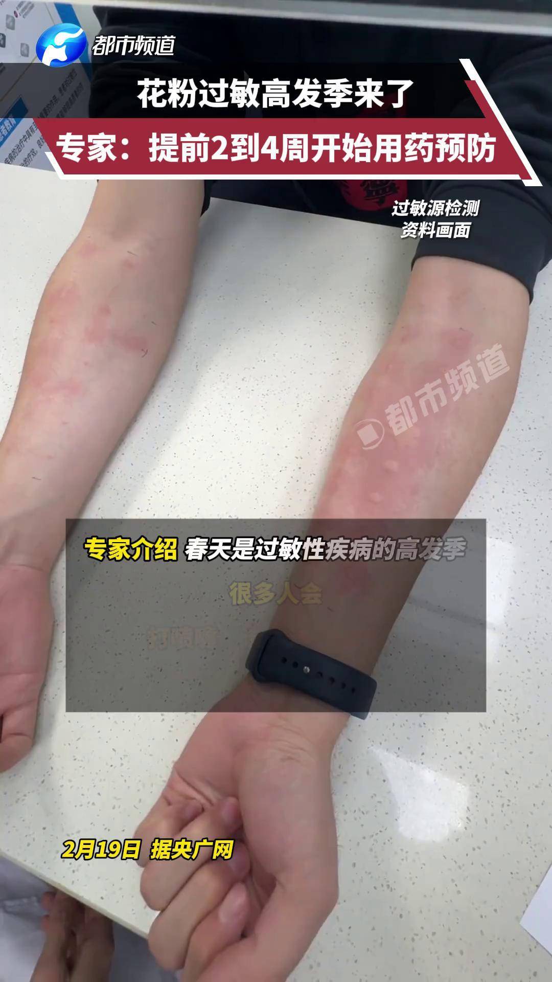 花粉过敏高发季来了!专家:提前2到4周开始用药预防